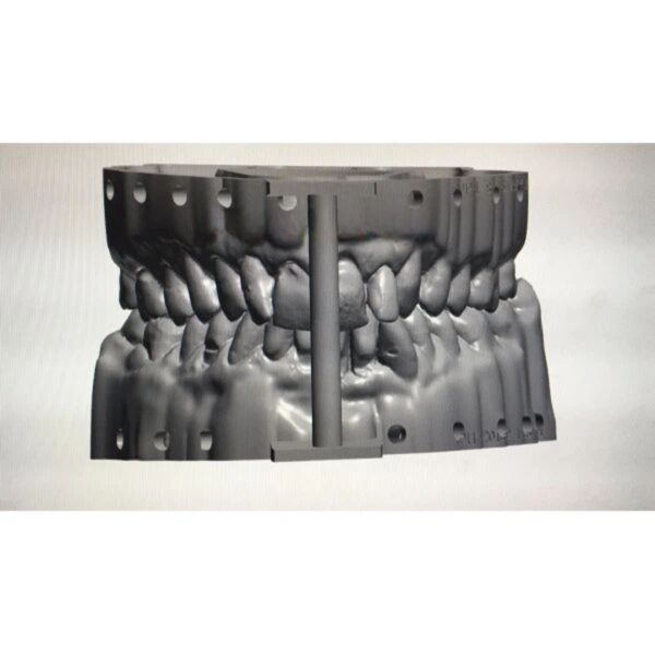 Professional Digital Dental Model Design | Expert 3D CAD Modeling Services China